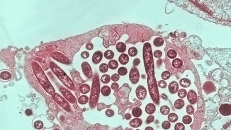 Piscinas na Maia fechadas há uma semana por suspeita de 'legionella'